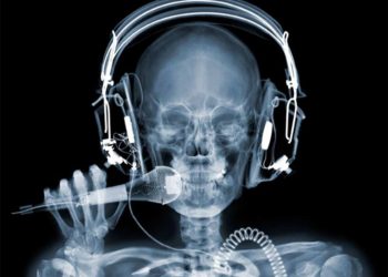 Tia X là gì? Những bí mật về loại tia này 