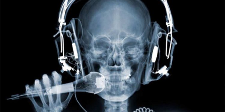 Tia X là gì? Những bí mật về loại tia này 