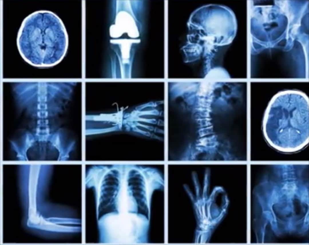 Giới thiệu về Tia X X-ray: Những Điều Cơ Bản