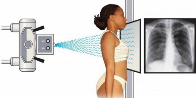 Lợi ích của Tia X X-ray trong chẩn đoán và điều trị bệnh