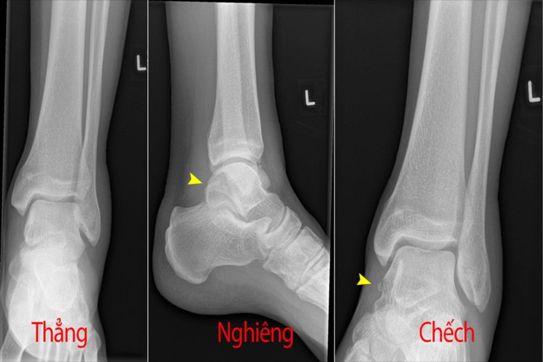 Tầm quan trọng của tia X-ray trong đời sống hiện nay